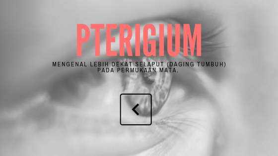 Pterigium
